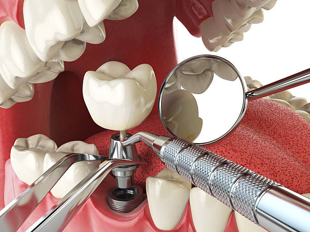 Best Emergency Broken Tooth Repair in Nanuet, NY